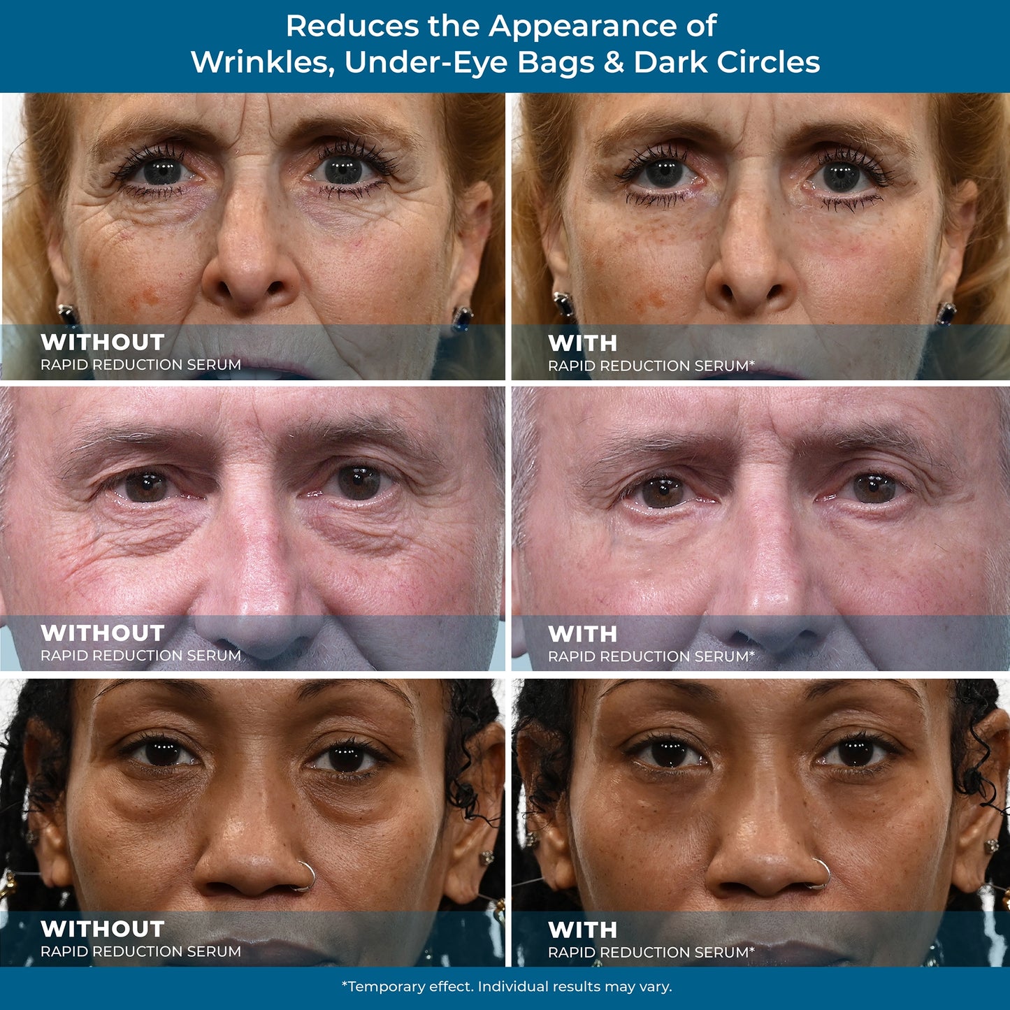 Plexaderm Rapid Reduction Eye Serum - Visibly ReducesUnder-Eye Bags, Wrinkles, Dark Circles, Fine Lines & Crow'sFeet Instantly, Anti Aging Wrinkle Remover for Face, Full SizeTube