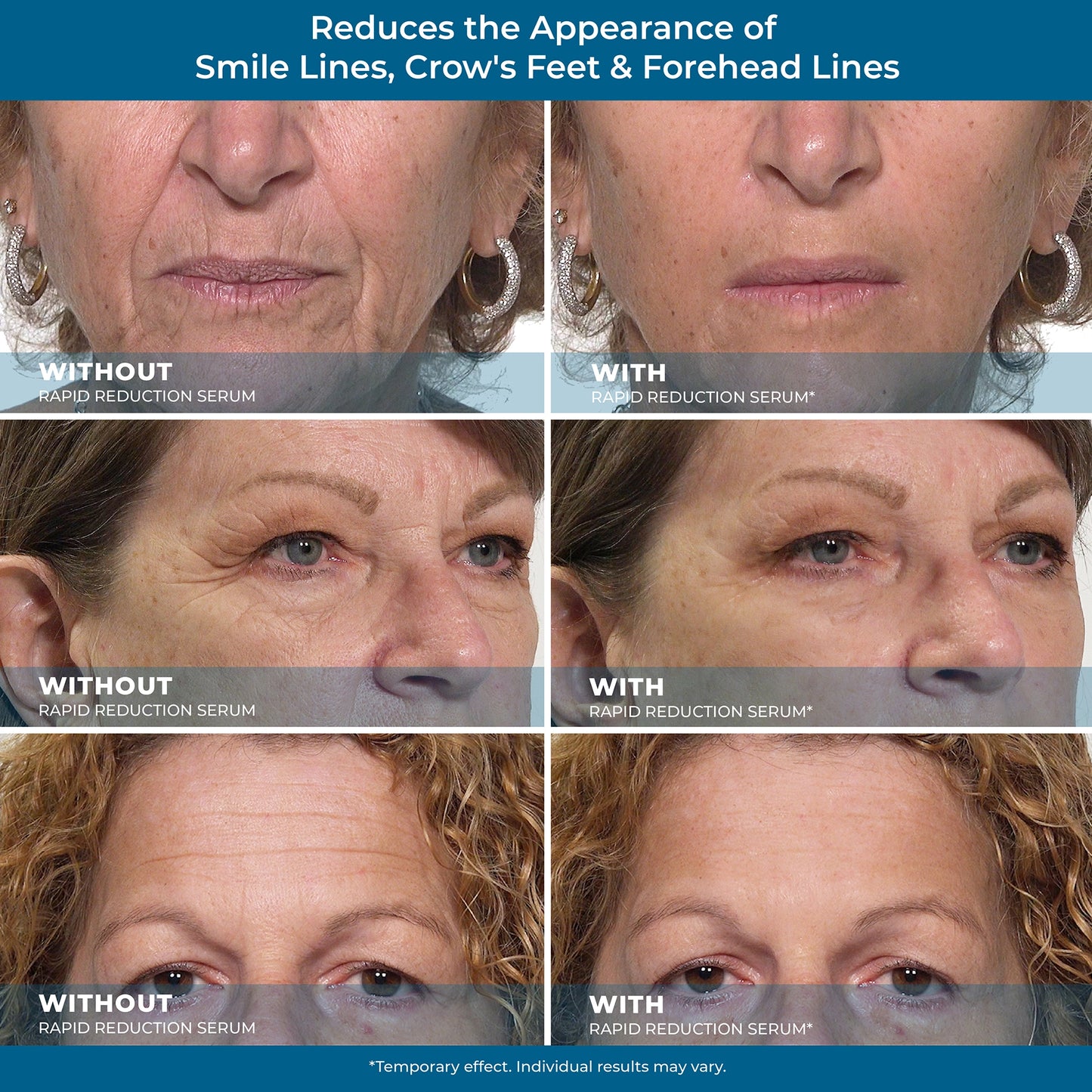 Plexaderm Rapid Reduction Eye Serum - Visibly ReducesUnder-Eye Bags, Wrinkles, Dark Circles, Fine Lines & Crow'sFeet Instantly, Anti Aging Wrinkle Remover for Face, Full SizeTube